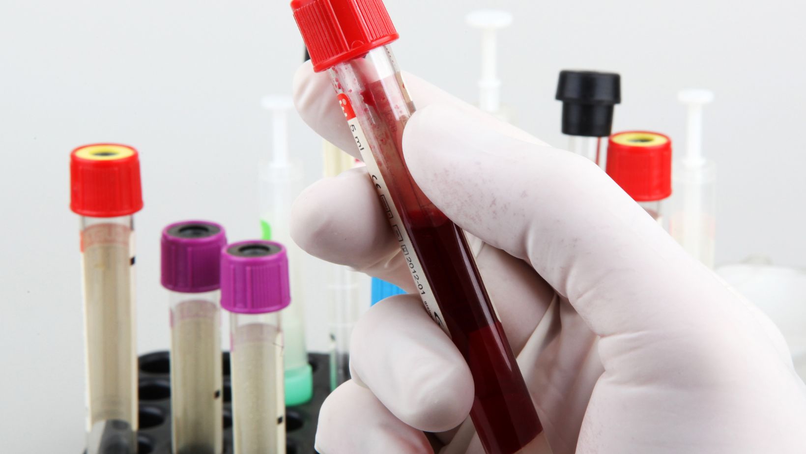 how do medical screenings help promote good health check all that apply key benefits explained